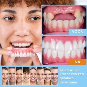 HEATWOLF® 💎Premium Geavanceerd Op Maat Gemaakt Volledig Kunstgebit Set💎 (⏰Tijdelijke korting, nog 30 minuten!)