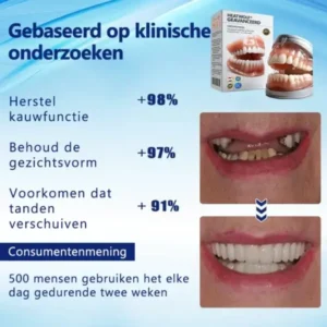 HEATWOLF® 💎Premium Geavanceerd Op Maat Gemaakt Volledig Kunstgebit Set💎 (⏰Tijdelijke korting, nog 30 minuten!)