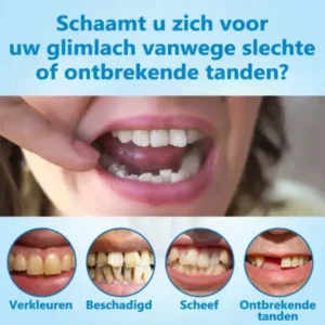 HEATWOLF® 💎Premium Geavanceerd Op Maat Gemaakt Volledig Kunstgebit Set💎 (⏰Tijdelijke korting, nog 30 minuten!)